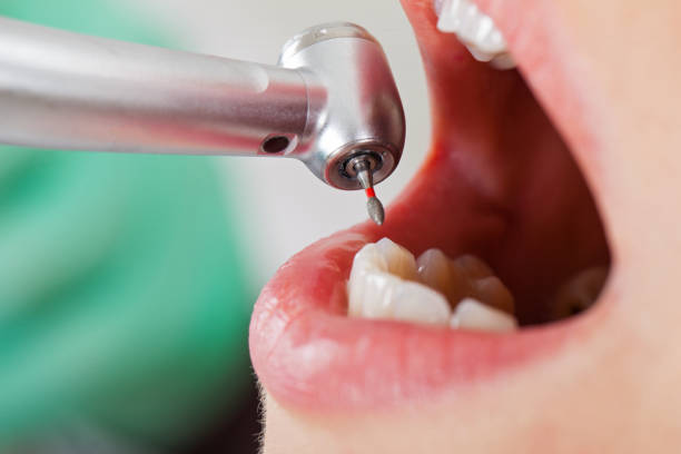 Best Pediatric Emergency Dentist in Berlin, NJ